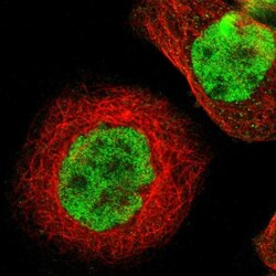 Th-POK Antibody, Novus Biologicals 25 &mu;L; Unlabeled:Antibodies, Polyclonal